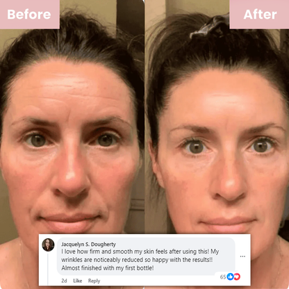 Nuvellis™ Glass Collagen Peel Of Facial Mask